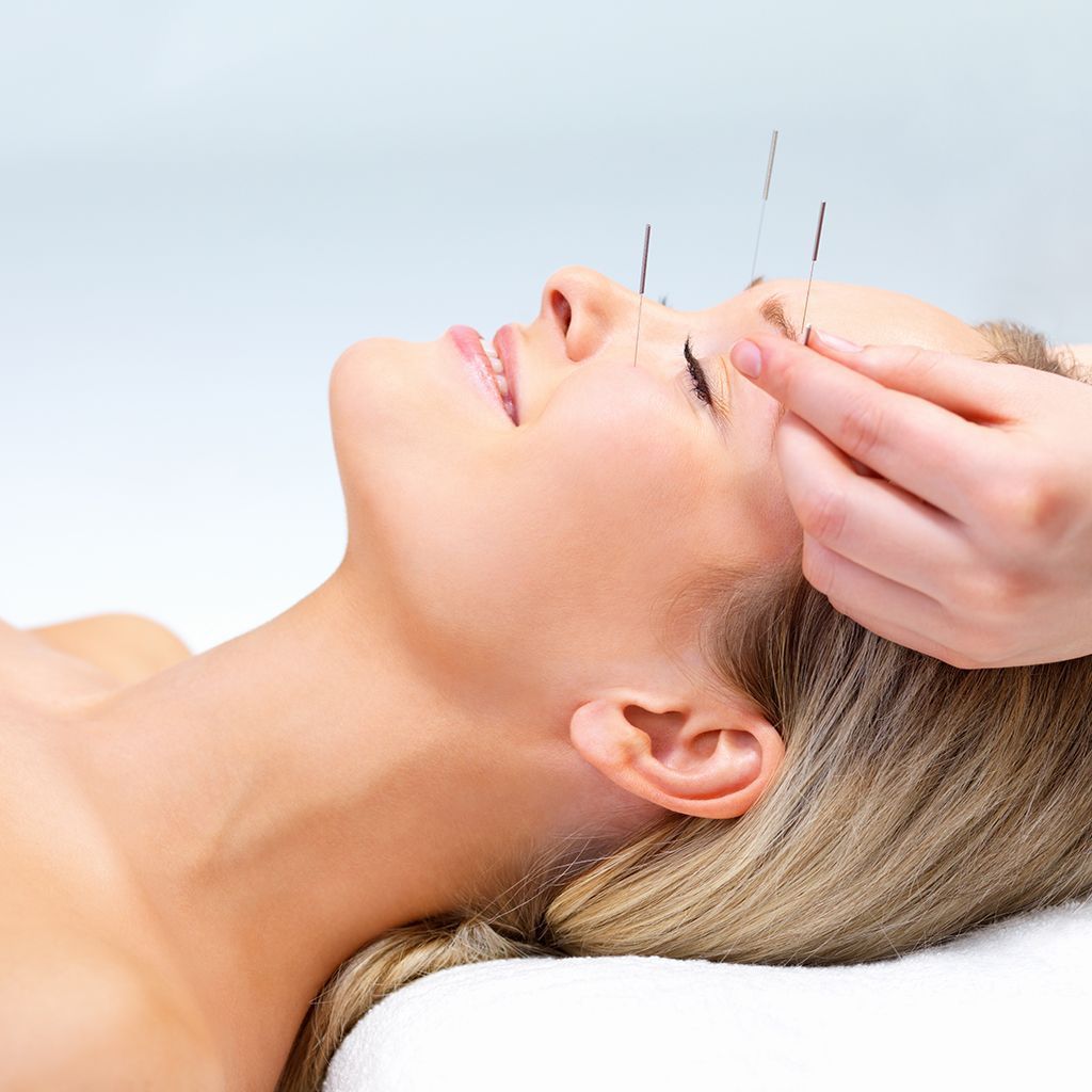 Le-lifting-par-acupuncture-en-5-questions